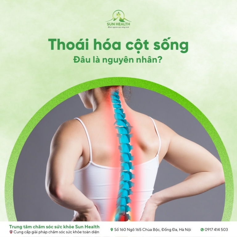 Thoái hoá cột sống đâu là nguyên nhân?