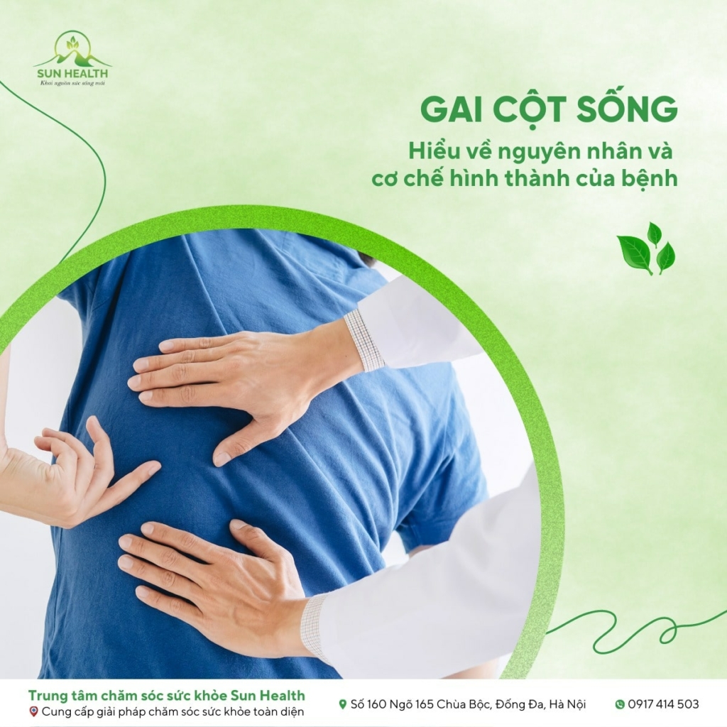 Gai cột sống nguyên nhân và cơ chế hình thành