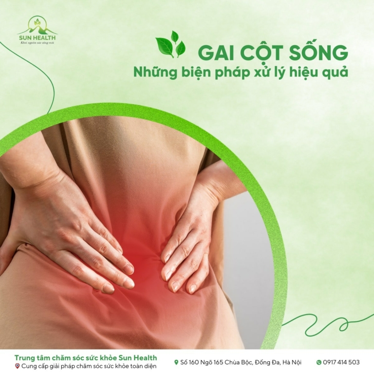 Gai cột sống và những biện pháp xử lý hiệu quả